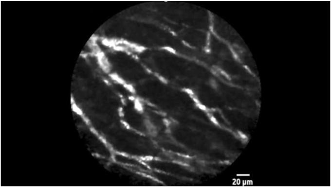 https://cdn.ncbi.nlm.nih.gov/pmc/blobs/63b3/12146039/d43e30de2b43/gr2.jpg