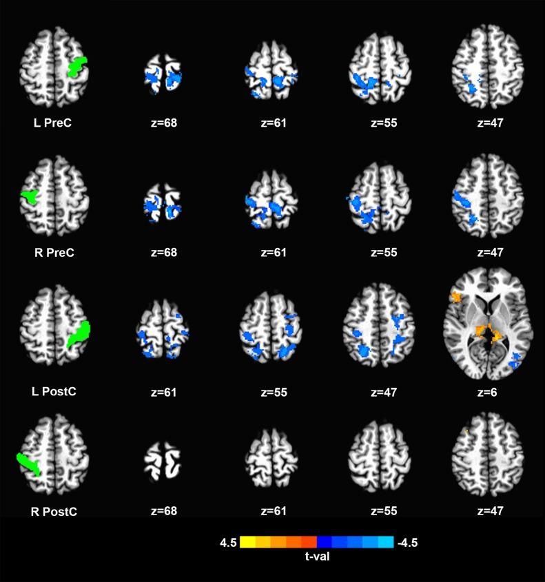 https://cdn.ncbi.nlm.nih.gov/pmc/blobs/63b3/4783046/0e4fe4df4400/pone.0150351.g002.jpg