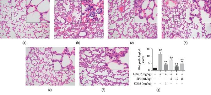 https://cdn.ncbi.nlm.nih.gov/pmc/blobs/63b5/6875290/7b68824ad87d/ECAM2019-9857683.002.jpg