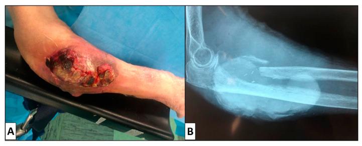 https://cdn.ncbi.nlm.nih.gov/pmc/blobs/63b5/7931074/0629822302c2/dermatopathology-08-00008-g001.jpg