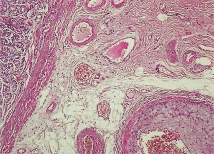 https://cdn.ncbi.nlm.nih.gov/pmc/blobs/63b6/3166813/9a30d225ecc2/crg0002-0469-f03.jpg