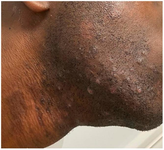 https://cdn.ncbi.nlm.nih.gov/pmc/blobs/63b7/10889290/497f6aacfbeb/jcm-13-01036-g002.jpg