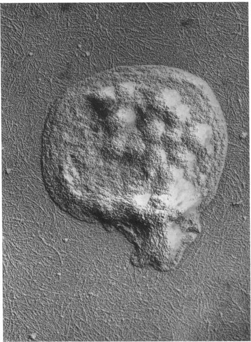 https://cdn.ncbi.nlm.nih.gov/pmc/blobs/63ba/302174/ee2469fd27b6/jcinvest00175-0244-a.jpg
