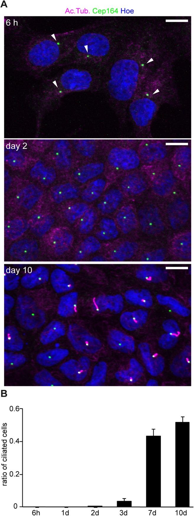 https://cdn.ncbi.nlm.nih.gov/pmc/blobs/63c1/4605505/b73012d1c516/pone.0140378.g003.jpg