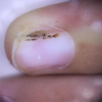 https://cdn.ncbi.nlm.nih.gov/pmc/blobs/63c7/10795093/7cfc41dc9a6f/SRT-30-e13584-g003.jpg