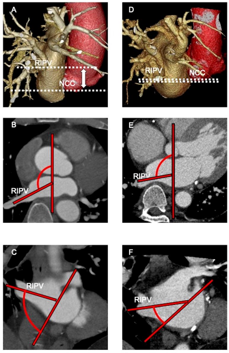 https://cdn.ncbi.nlm.nih.gov/pmc/blobs/63c7/8739445/8cd1db44cd87/openhrt-2021-001724f05.jpg