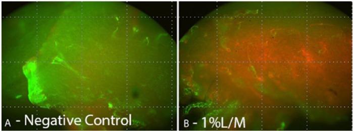 https://cdn.ncbi.nlm.nih.gov/pmc/blobs/63c9/4462250/91909091bae5/10.1177_1947603515571001-fig2.jpg