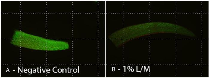 https://cdn.ncbi.nlm.nih.gov/pmc/blobs/63c9/4462250/debb3f33a0d6/10.1177_1947603515571001-fig1.jpg
