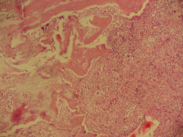 https://cdn.ncbi.nlm.nih.gov/pmc/blobs/63d3/2639602/f7f5f1d138b4/1752-1947-3-35-1.jpg