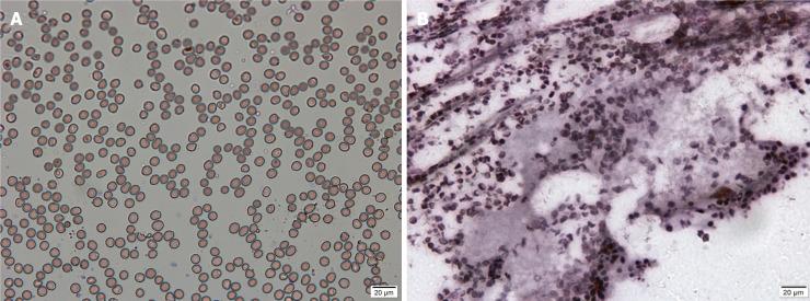 https://cdn.ncbi.nlm.nih.gov/pmc/blobs/63d3/8567504/9de16ba98835/WJCC-9-9255-g005.jpg