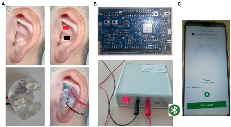 https://cdn.ncbi.nlm.nih.gov/pmc/blobs/63d4/10083261/a99ffd081bd8/fnins-17-1096865-g001.jpg