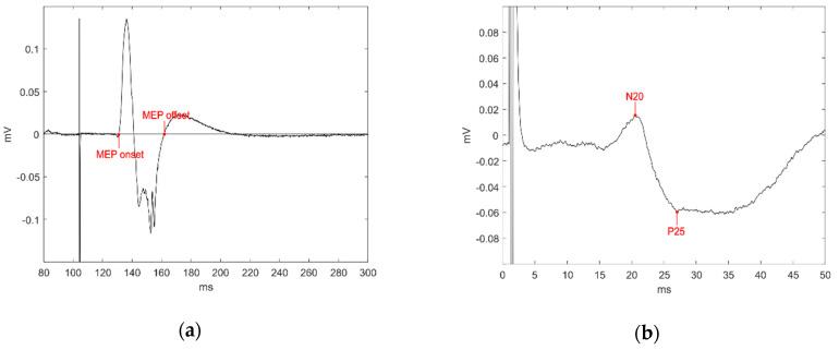 https://cdn.ncbi.nlm.nih.gov/pmc/blobs/63d4/11048666/d6ab142cda14/brainsci-14-00371-g001.jpg