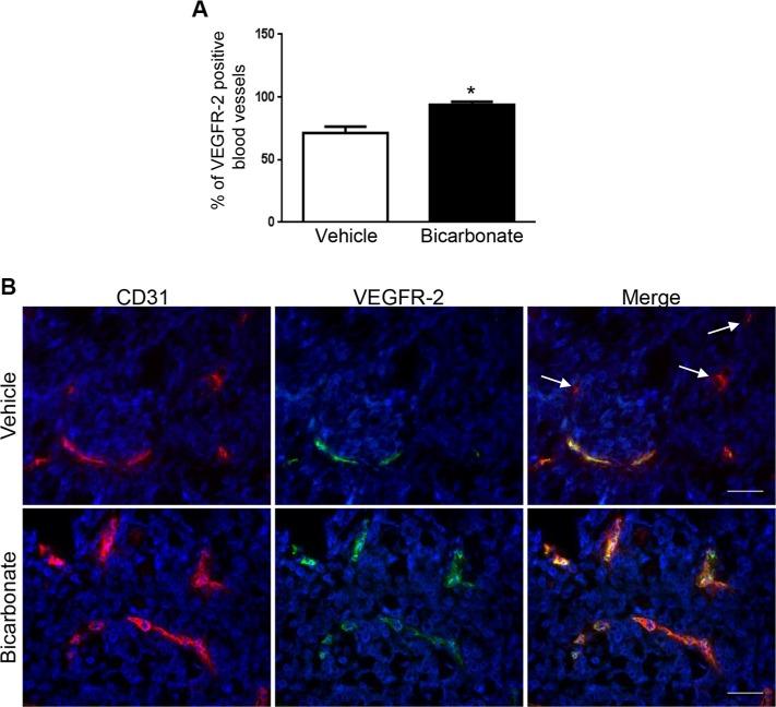 https://cdn.ncbi.nlm.nih.gov/pmc/blobs/63d5/5349894/0e103583982a/oncotarget-07-86026-g005.jpg
