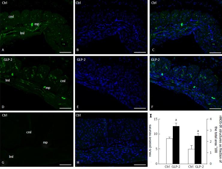 https://cdn.ncbi.nlm.nih.gov/pmc/blobs/63d7/5677198/eda55a0bfe18/WJG-23-7211-g006.jpg