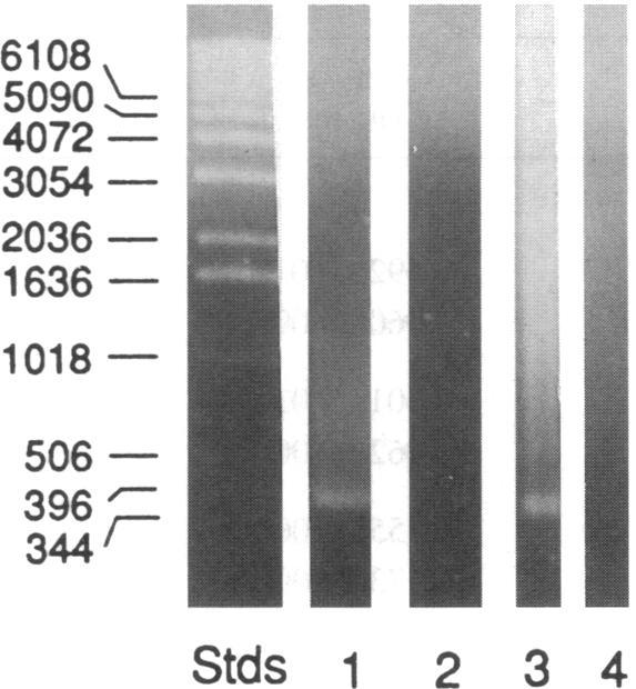 https://cdn.ncbi.nlm.nih.gov/pmc/blobs/63d8/296131/6ca069662bc2/jcinvest00020-0103-d.jpg