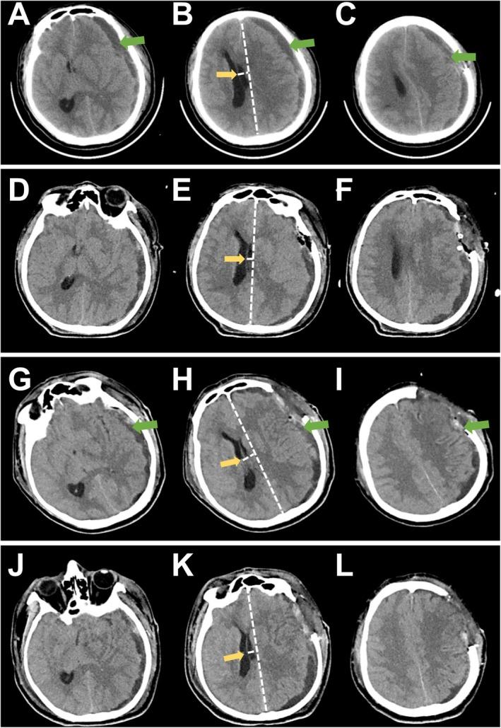 https://cdn.ncbi.nlm.nih.gov/pmc/blobs/63de/12259495/6de404078049/CCR3-13-e70619-g002.jpg