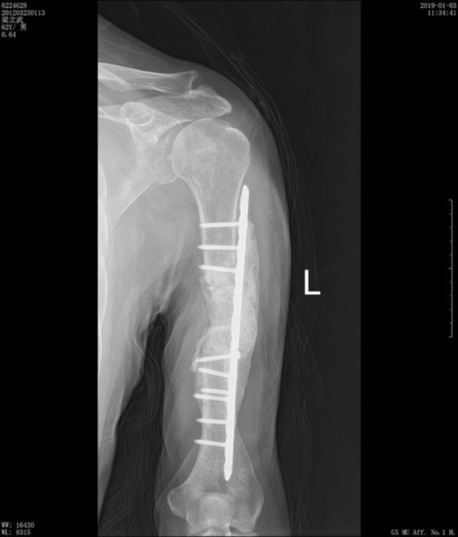 https://cdn.ncbi.nlm.nih.gov/pmc/blobs/63e8/12045782/48b41d5866d9/CCR3-13-e70418-g003.jpg