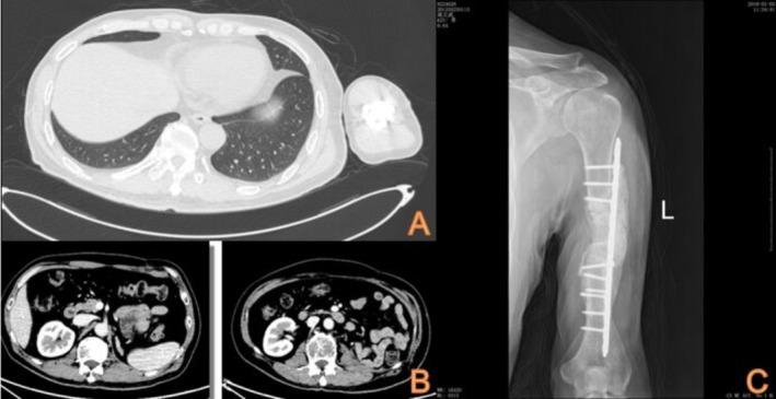 https://cdn.ncbi.nlm.nih.gov/pmc/blobs/63e8/12045782/4a80e2dbc7c1/CCR3-13-e70418-g005.jpg