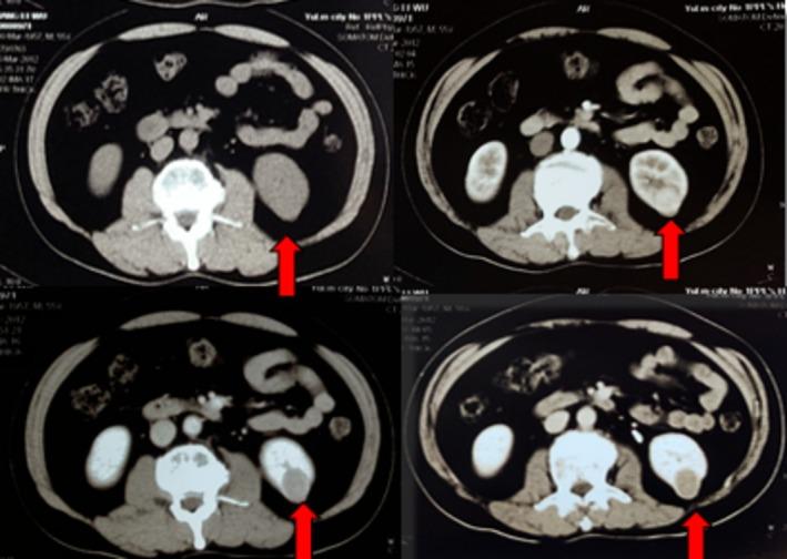 https://cdn.ncbi.nlm.nih.gov/pmc/blobs/63e8/12045782/617a18ee0443/CCR3-13-e70418-g004.jpg