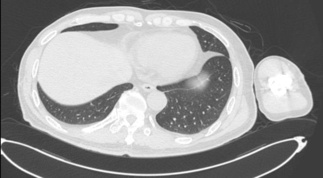 https://cdn.ncbi.nlm.nih.gov/pmc/blobs/63e8/12045782/8e90a1a15a48/CCR3-13-e70418-g008.jpg