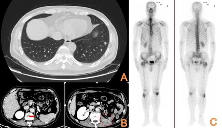 https://cdn.ncbi.nlm.nih.gov/pmc/blobs/63e8/12045782/b42cbe59394a/CCR3-13-e70418-g002.jpg
