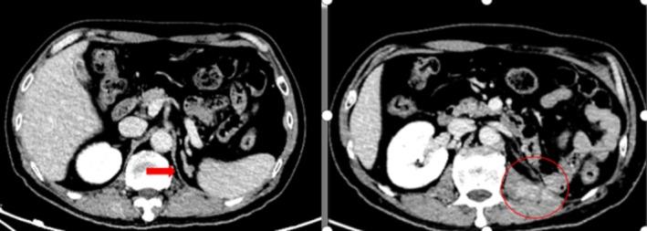 https://cdn.ncbi.nlm.nih.gov/pmc/blobs/63e8/12045782/b6489220ebf8/CCR3-13-e70418-g001.jpg