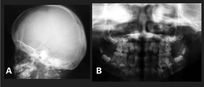 https://cdn.ncbi.nlm.nih.gov/pmc/blobs/63e9/3005677/7ddd8ba70214/JCRPE-2-134-g2.jpg