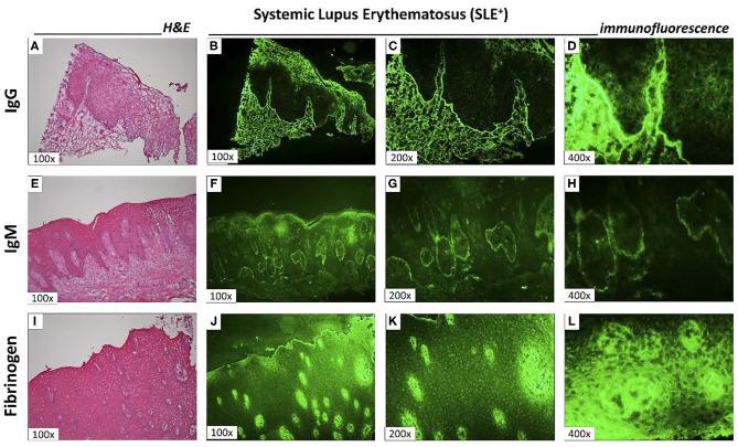 https://cdn.ncbi.nlm.nih.gov/pmc/blobs/63eb/8027066/6bdbec308de5/fimmu-12-591236-g0003.jpg