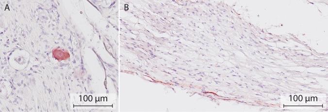 https://cdn.ncbi.nlm.nih.gov/pmc/blobs/63f9/10944453/8d23cfd28153/10286_2024_1023_Fig2_HTML.jpg