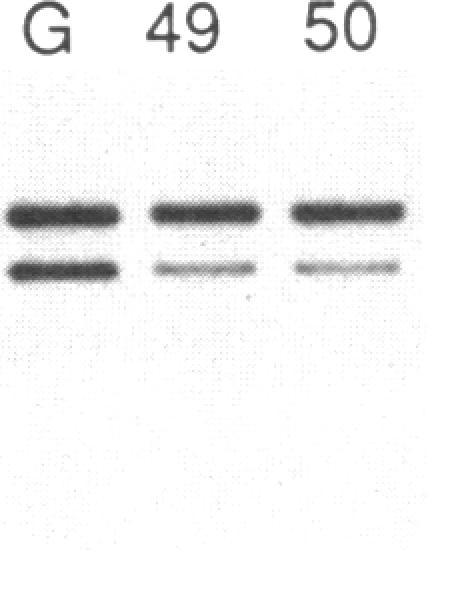 https://cdn.ncbi.nlm.nih.gov/pmc/blobs/6401/442452/59f3aab581f6/jcinvest00096-0267-h.jpg