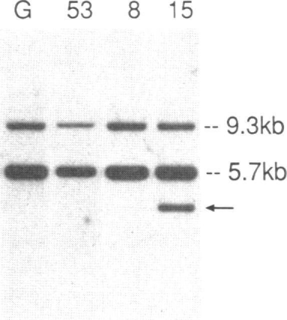 https://cdn.ncbi.nlm.nih.gov/pmc/blobs/6401/442452/93261899ef5f/jcinvest00096-0267-l.jpg