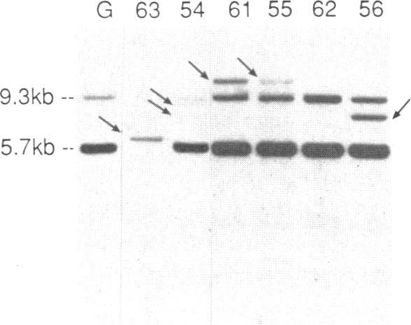 https://cdn.ncbi.nlm.nih.gov/pmc/blobs/6401/442452/e5f472503863/jcinvest00096-0267-m.jpg