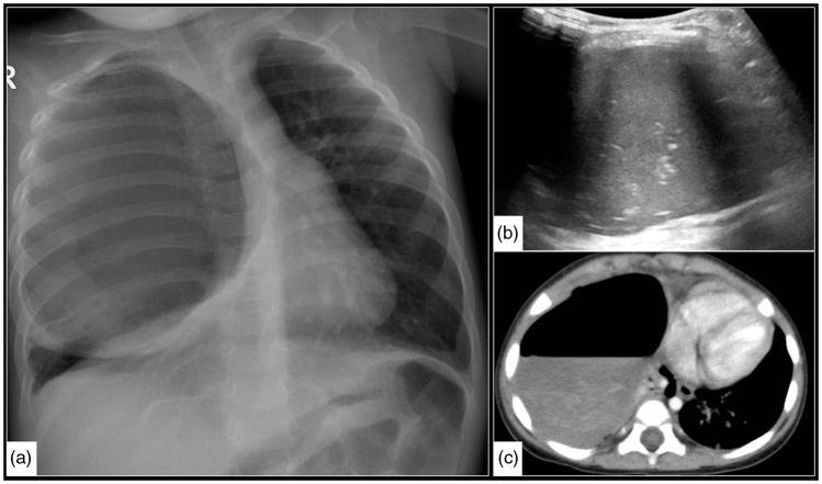 https://cdn.ncbi.nlm.nih.gov/pmc/blobs/6403/6545655/825caf22d05f/10.1177_2058460119851998-fig2.jpg