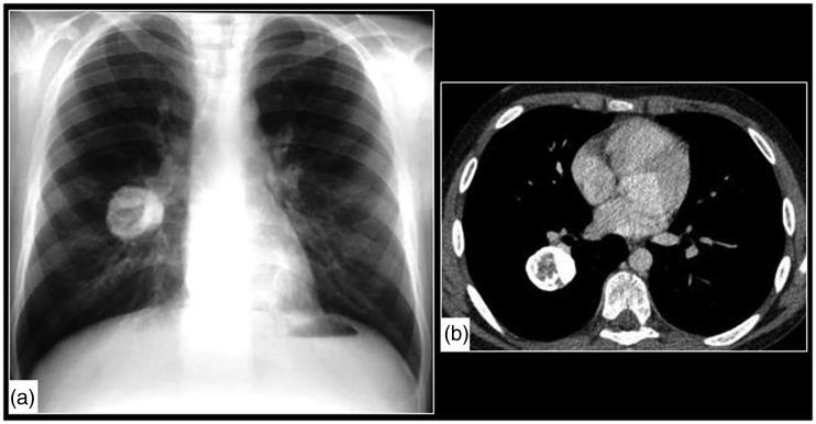 https://cdn.ncbi.nlm.nih.gov/pmc/blobs/6403/6545655/a7dbe31801a8/10.1177_2058460119851998-fig8.jpg