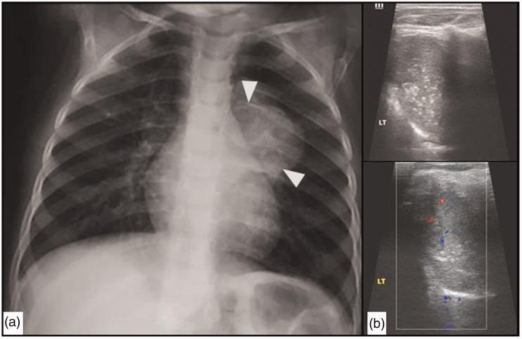 https://cdn.ncbi.nlm.nih.gov/pmc/blobs/6403/6545655/ed9b60de6f5d/10.1177_2058460119851998-fig12.jpg