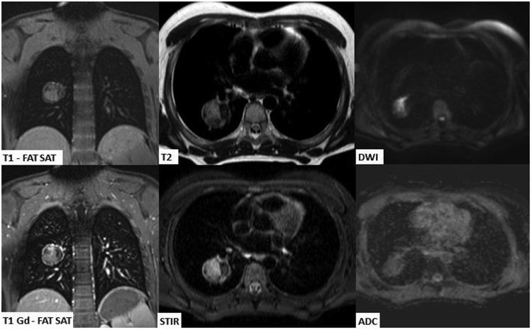 https://cdn.ncbi.nlm.nih.gov/pmc/blobs/6403/6545655/fe189373f192/10.1177_2058460119851998-fig9.jpg