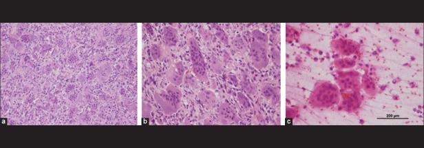 https://cdn.ncbi.nlm.nih.gov/pmc/blobs/640a/3515947/19b1b8387153/SNI-3-140-g007.jpg