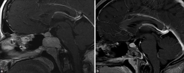 https://cdn.ncbi.nlm.nih.gov/pmc/blobs/640a/3515947/6e71023f8c39/SNI-3-140-g006.jpg