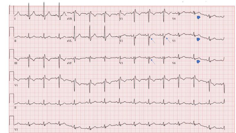 https://cdn.ncbi.nlm.nih.gov/pmc/blobs/640a/7606194/3c2361695852/cureus-0012-00000010773-i01.jpg
