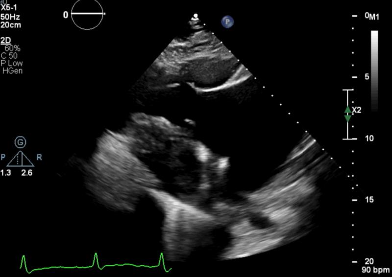 https://cdn.ncbi.nlm.nih.gov/pmc/blobs/640a/7606194/96bc0b4e3056/cureus-0012-00000010773-i02.jpg