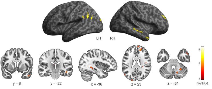https://cdn.ncbi.nlm.nih.gov/pmc/blobs/6418/7668216/1bcd1b8425d8/fnhum-14-552111-g0003.jpg