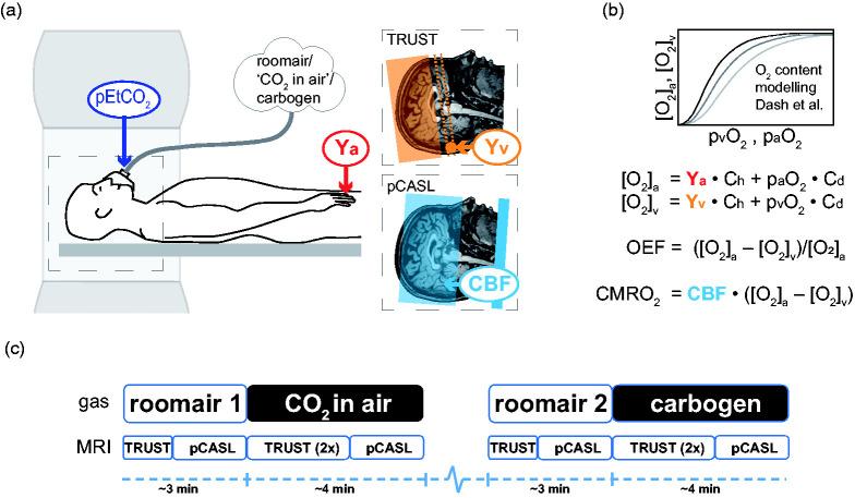 https://cdn.ncbi.nlm.nih.gov/pmc/blobs/6419/9014679/847ed585eae1/10.1177_0271678X211064572-fig1.jpg
