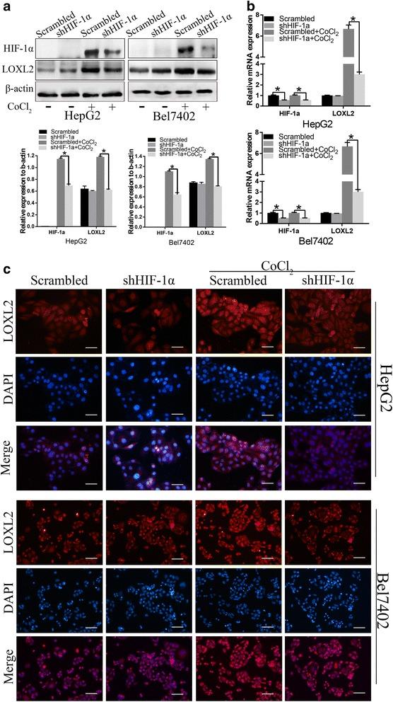 https://cdn.ncbi.nlm.nih.gov/pmc/blobs/642b/5408450/7138b1cd3bd7/13046_2017_533_Fig2_HTML.jpg