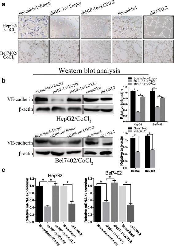 https://cdn.ncbi.nlm.nih.gov/pmc/blobs/642b/5408450/e9d2889359cb/13046_2017_533_Fig4_HTML.jpg
