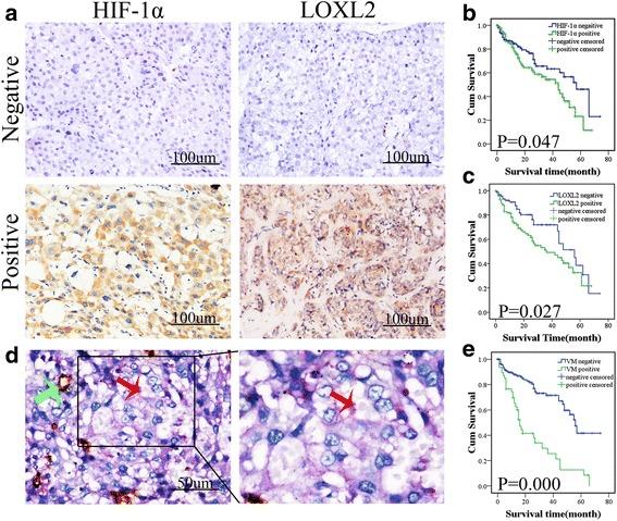 https://cdn.ncbi.nlm.nih.gov/pmc/blobs/642b/5408450/f9cbb18139c2/13046_2017_533_Fig1_HTML.jpg