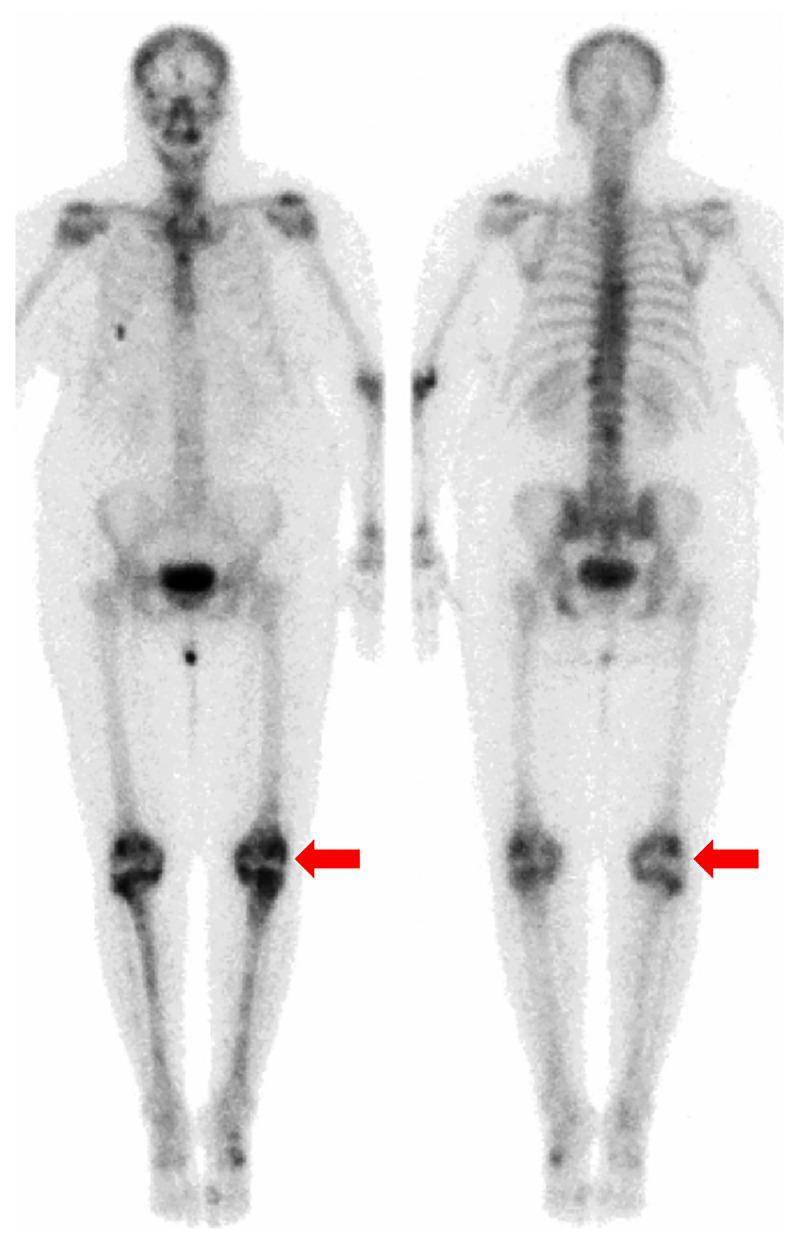 https://cdn.ncbi.nlm.nih.gov/pmc/blobs/642d/10993734/1873d795b07e/amjcaserep-25-e941169-g002.jpg