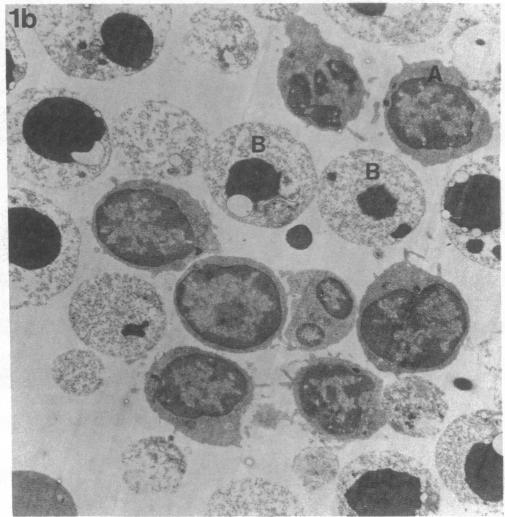 https://cdn.ncbi.nlm.nih.gov/pmc/blobs/642e/296596/785e264aceba/jcinvest00071-0158-b.jpg