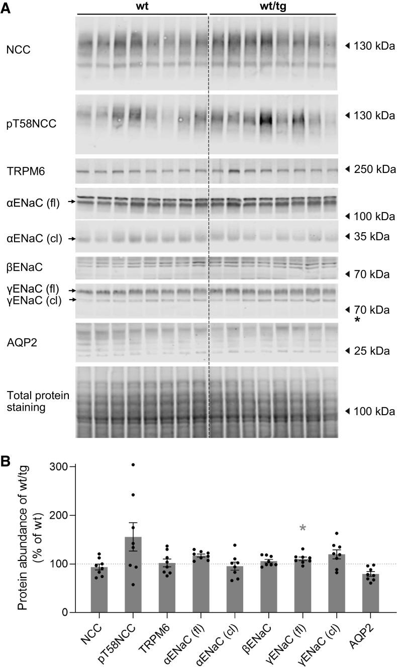 https://cdn.ncbi.nlm.nih.gov/pmc/blobs/6431/10085568/0442436299b5/ajprenal.00250.2022_f008.jpg