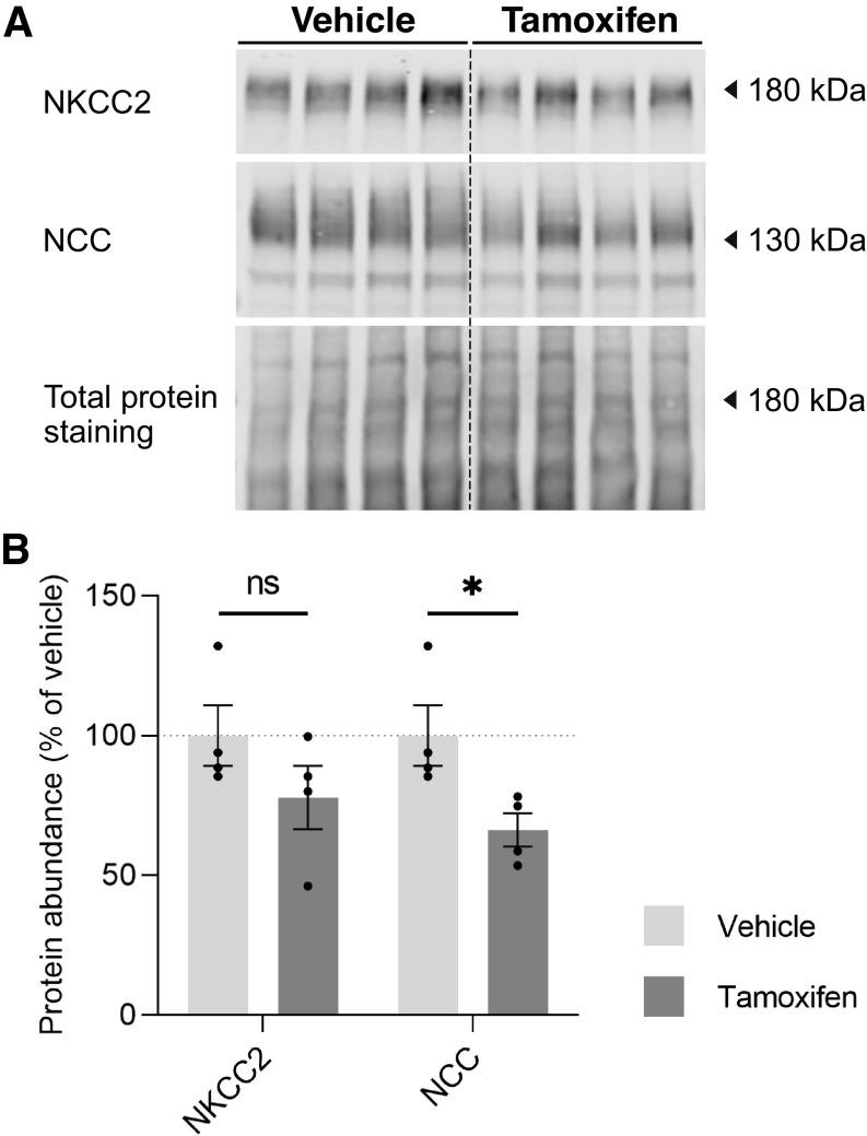 https://cdn.ncbi.nlm.nih.gov/pmc/blobs/6431/10085568/af9ea4aa7ca3/ajprenal.00250.2022_f004.jpg