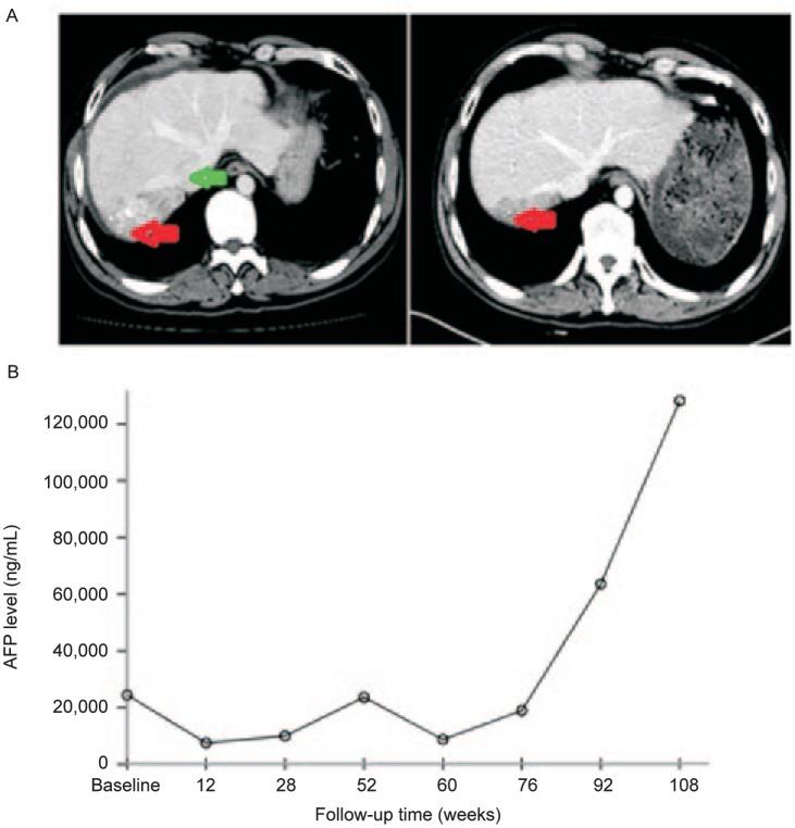 https://cdn.ncbi.nlm.nih.gov/pmc/blobs/6433/4026547/29c20d9ac777/cjc-33-05-259-g001.jpg
